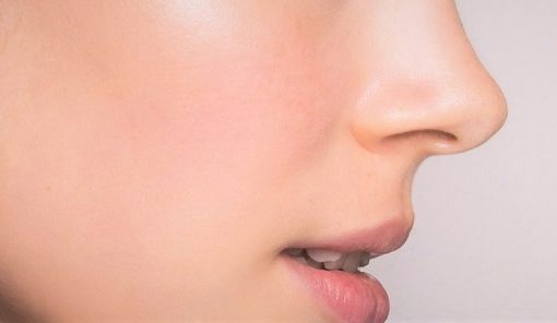 rhinoplastie chirurgie du nez